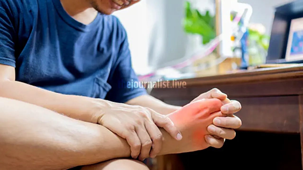 Uric Acid